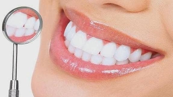Blanqueamiento dental :Dientes más blancos, sonrisas más luminosas