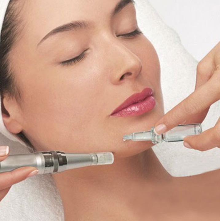 Dermapen facial y láser: mejora tu piel en pocas sesiones