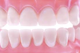 cirugía periodontal
