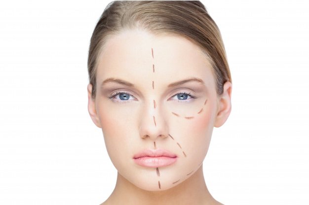 ¿Qué es la asimetría facial?