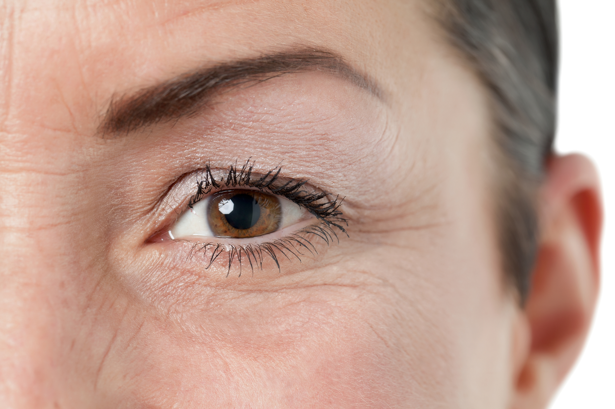 Mejora tus ojos eliminando la piel de párpados