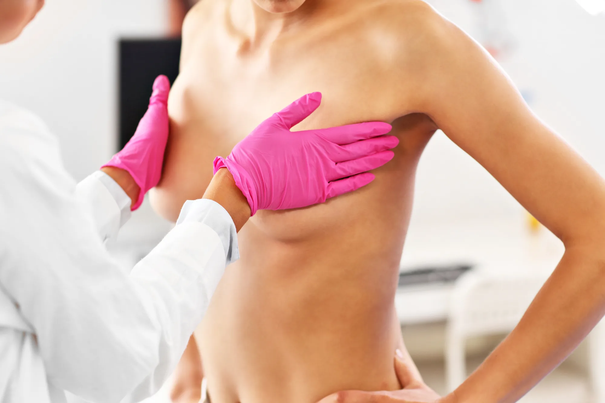 ¿Qué es una mastectomía profiláctica?